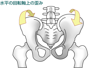 水平回転軸上の歪み